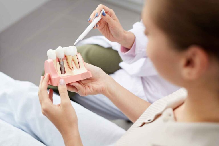 Fact or fiction? Experts debunk 6 common myths about dental implants
