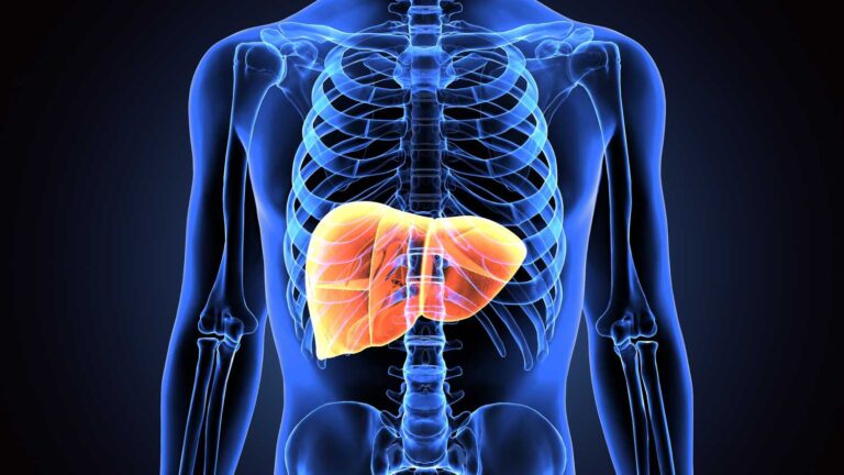 Non-alcoholic fatty liver disease – what is it and how can I reduce my risk?